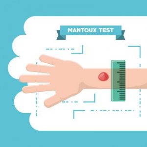 test di Mantoux