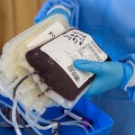 terapia al plasma