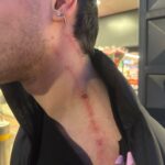 La foto del giovane di 27 anni di Sezze aggredito alla stazione e derubato della catenina d'oro