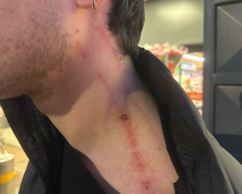 La foto del giovane di 27 anni di Sezze aggredito alla stazione e derubato della catenina d'oro