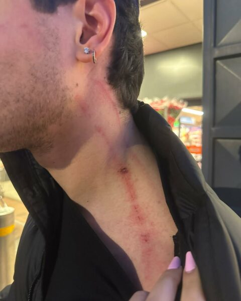 La foto del giovane di 27 anni di Sezze aggredito alla stazione e derubato della catenina d'oro