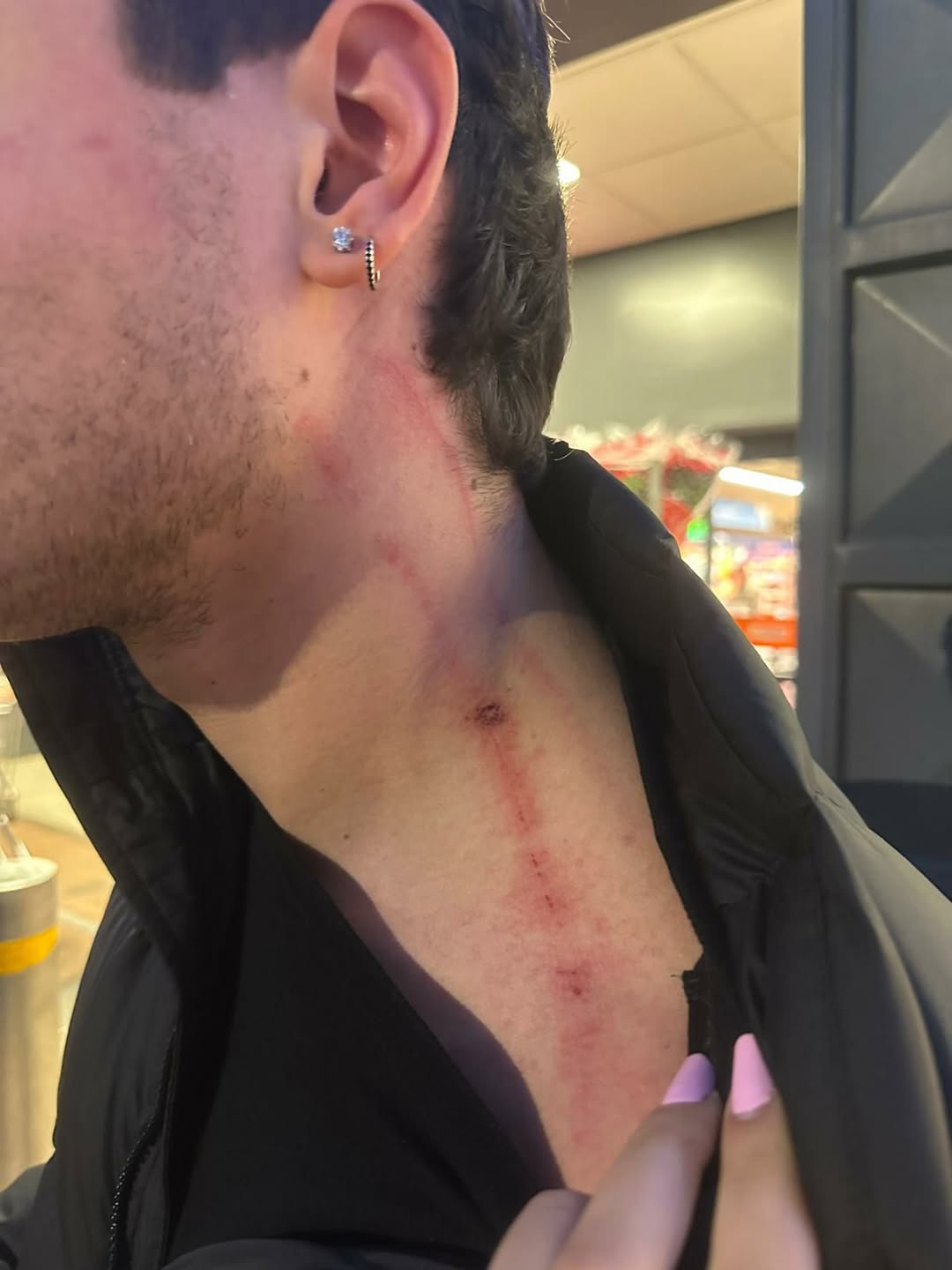 La foto del giovane di 27 anni di Sezze aggredito alla stazione e derubato della catenina d'oro